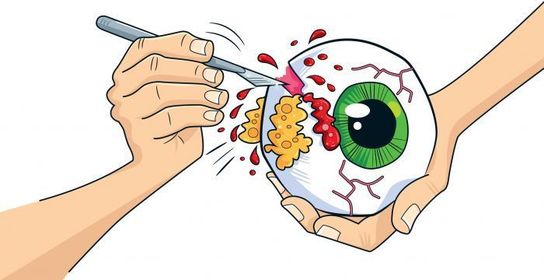 Gross Science Eyeball Dissection